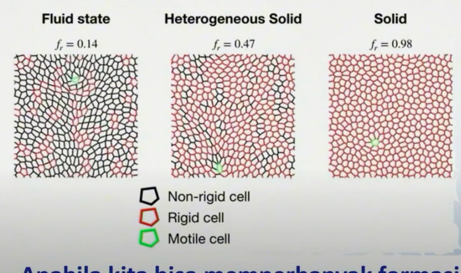 bentuk-sel-tumor