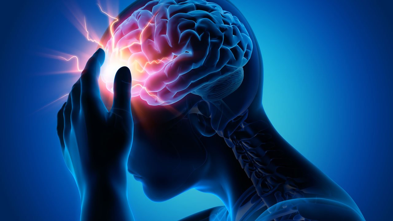 stroke